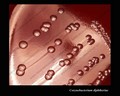 corynebacterium diphtheriae